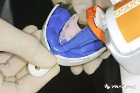 牙胶尖什么颜色早读 ｜ 几十年牙医总结临床经验，现在只需几分钟便可全部了解！_https://www.jmylbn.com_新闻资讯_第11张