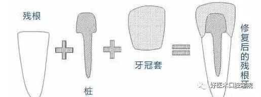 牙胶尖什么颜色早读 ｜ 几十年牙医总结临床经验，现在只需几分钟便可全部了解！_https://www.jmylbn.com_新闻资讯_第18张