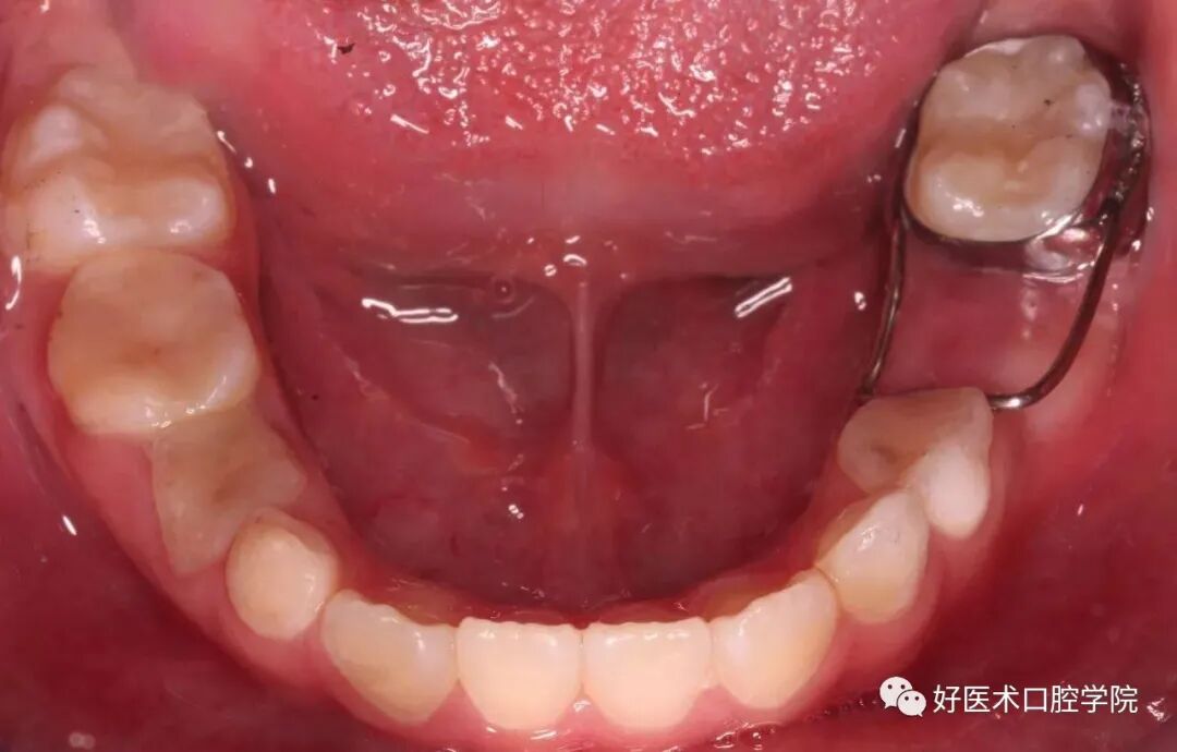 牙胶尖什么颜色早读 ｜ 几十年牙医总结临床经验，现在只需几分钟便可全部了解！_https://www.jmylbn.com_新闻资讯_第14张