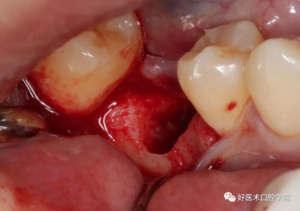 牙胶尖什么颜色早读 ｜ 几十年牙医总结临床经验，现在只需几分钟便可全部了解！_https://www.jmylbn.com_新闻资讯_第12张