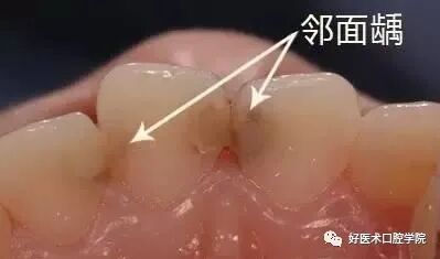牙胶尖什么颜色早读 ｜ 几十年牙医总结临床经验，现在只需几分钟便可全部了解！_https://www.jmylbn.com_新闻资讯_第28张