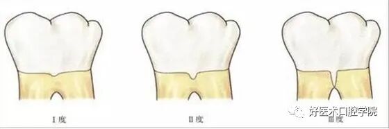 牙胶尖什么颜色早读 ｜ 几十年牙医总结临床经验，现在只需几分钟便可全部了解！_https://www.jmylbn.com_新闻资讯_第8张