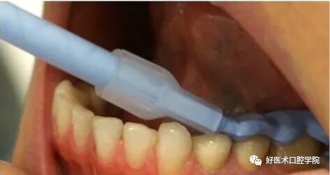 牙胶尖什么颜色早读 ｜ 几十年牙医总结临床经验，现在只需几分钟便可全部了解！_https://www.jmylbn.com_新闻资讯_第23张