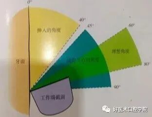 牙周刮治技术，从检查到操作方法，全套要点总结！
