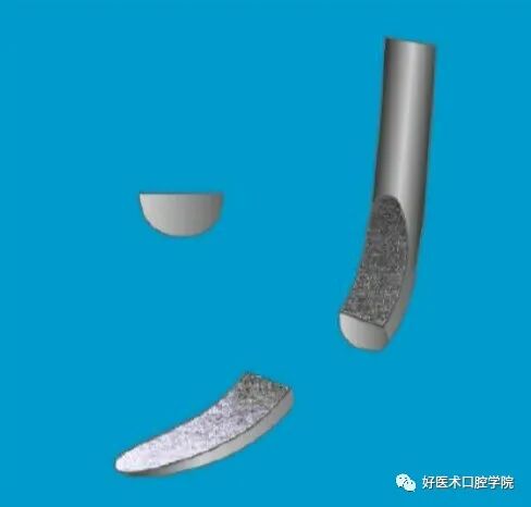 牙周刮治技术，从检查到操作方法，全套要点总结！