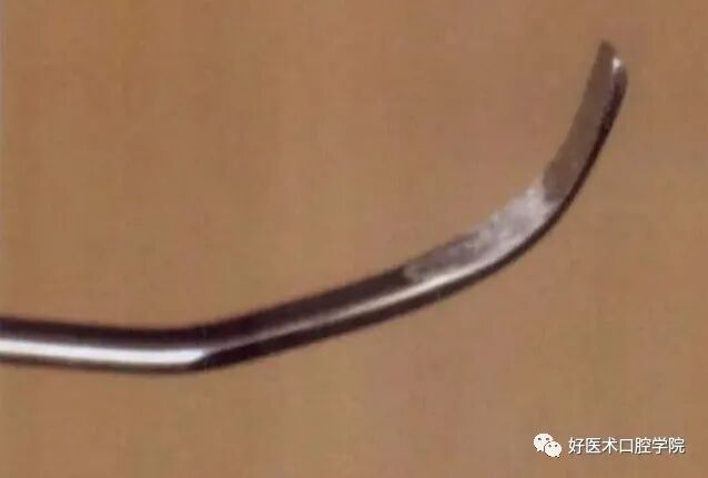 牙周刮治技术，从检查到操作方法，全套要点总结！