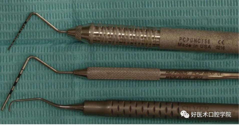 牙周刮治技术，从检查到操作方法，全套要点总结！