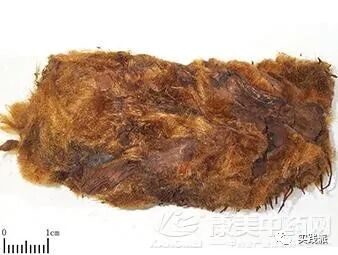 止血毛叫什么名字狗脊毛外用止血卓有成效_https://www.jmylbn.com_新闻资讯_第2张