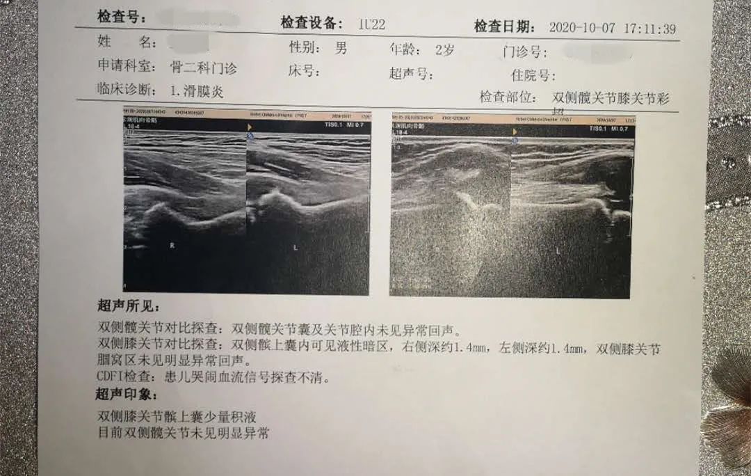 孩子突然说腿疼，走不了路，是为什么呢？