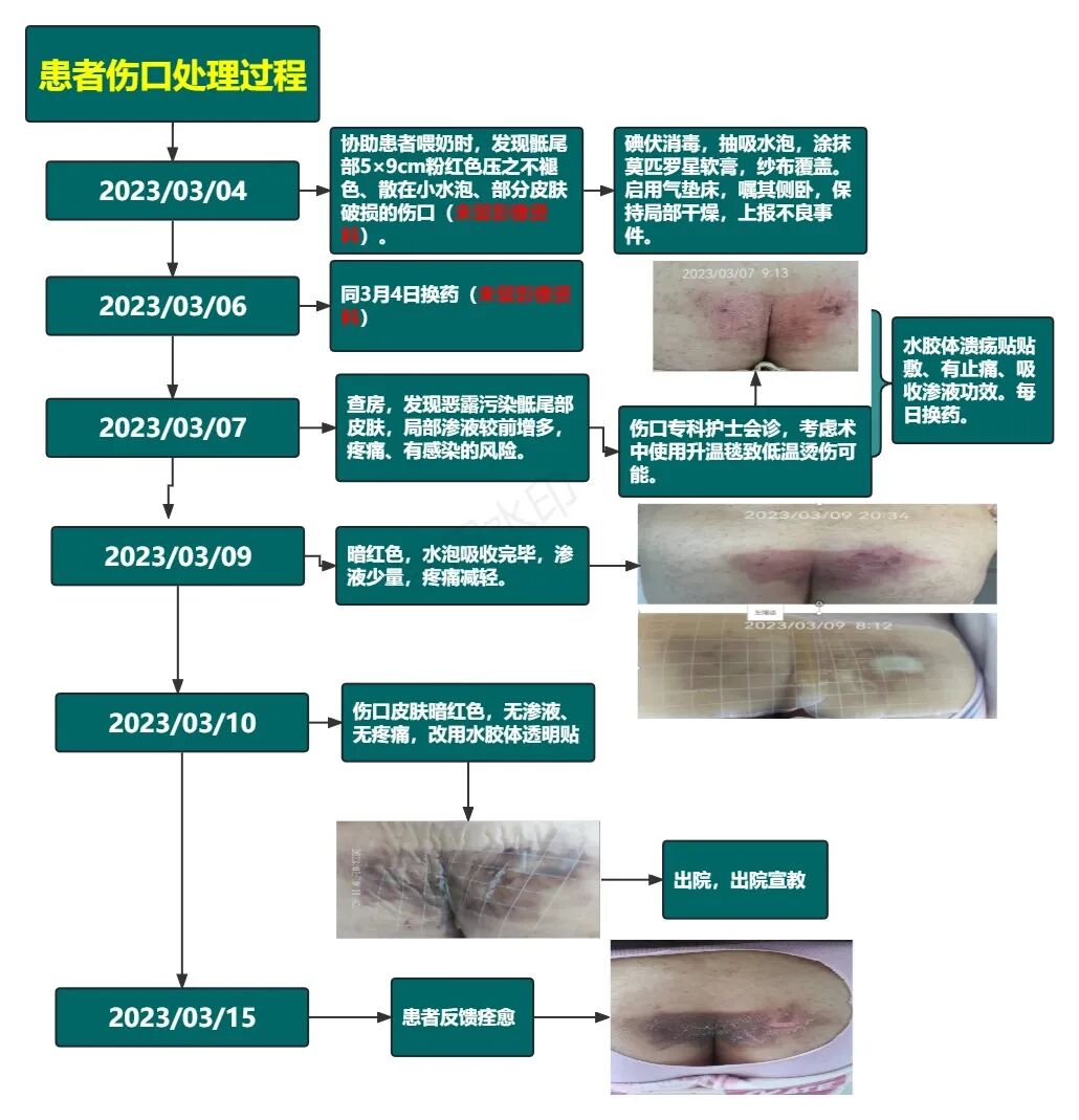 升温毯费用怎么开剖腹产术后：压力性损伤还是低温烫伤？_https://www.jmylbn.com_新闻资讯_第5张