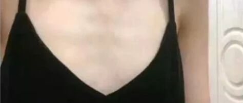 ​“医生说我胸小还笑出声？伤害性不大，侮辱性极强！”