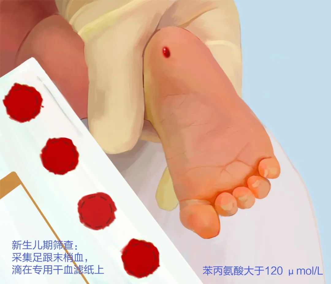 采集足跟血的作用是什么？不采可以吗？