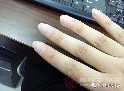 手癣的症状是什么