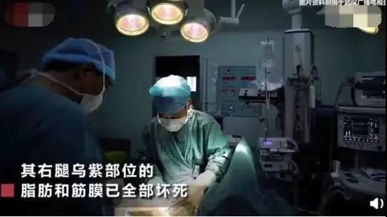 挠破蚊子包，4岁女童大腿坏死险丧命：被蚊子叮后的第一件事，9