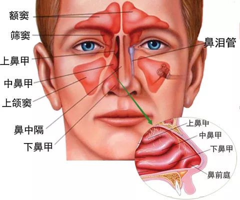 鼻前庭囊肿 王美荣耳鼻咽喉眩晕工作室 微信公众号文章阅读 Wemp