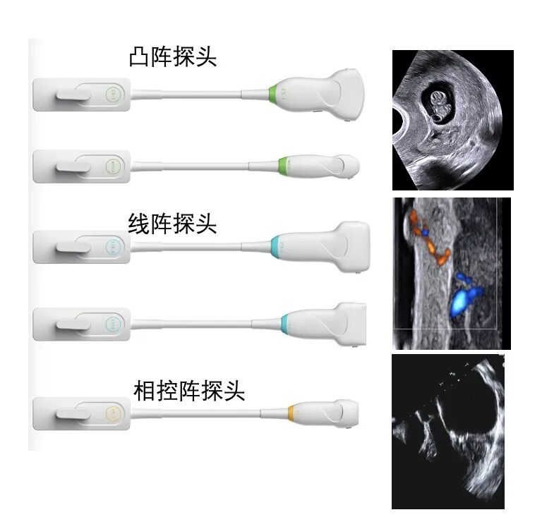 什么是超声容积探头超声探头分类及工作原理_https://www.jmylbn.com_新闻资讯_第11张