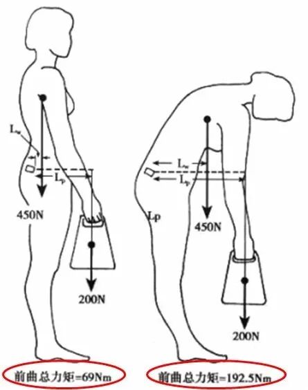 自测一下，看看你的腰突是哪个程度？