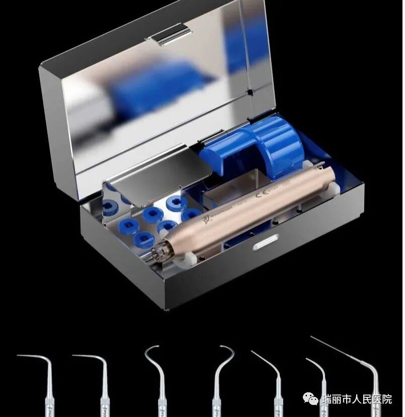 牙周治疗仪怎么做牙周牙周健康与治疗 --瑞丽市人民医院口腔科_https://www.jmylbn.com_新闻资讯_第3张