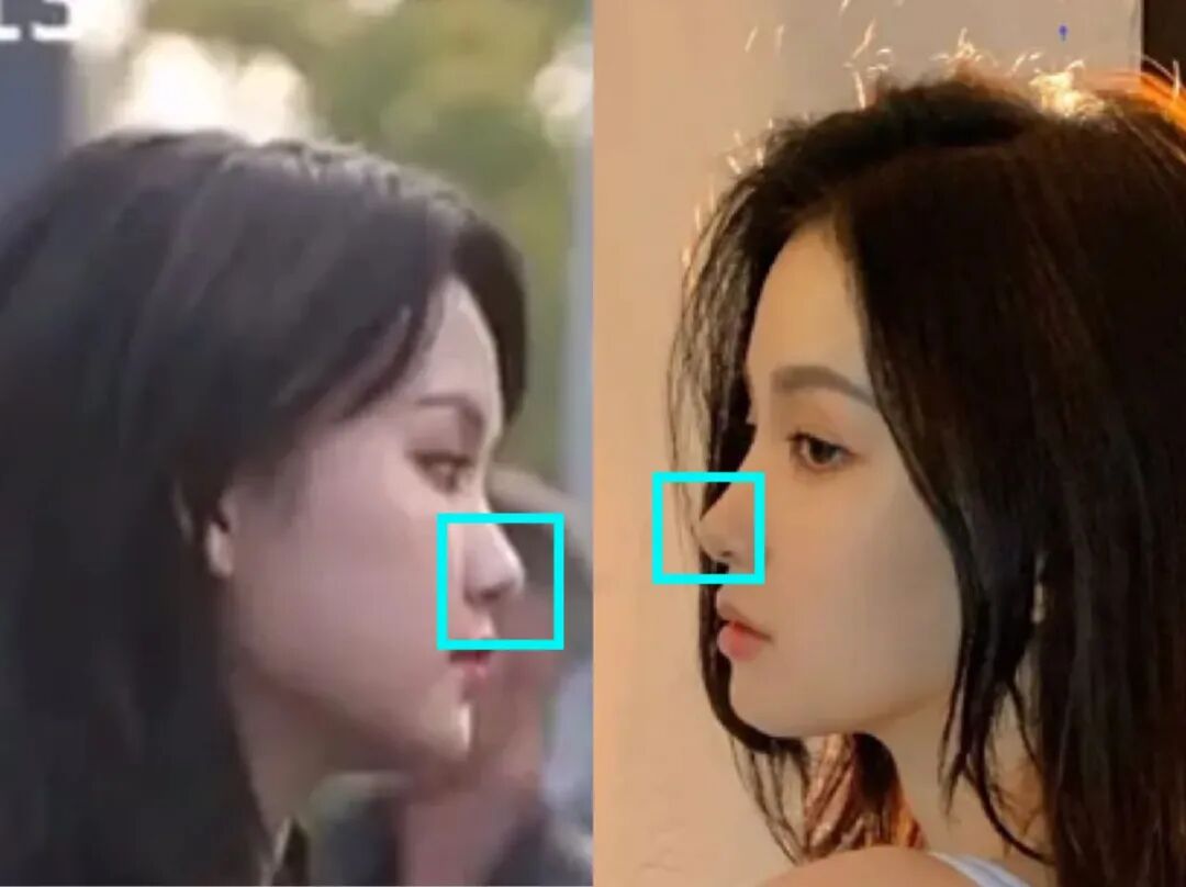 因太美遭霸凌，20岁嫁富二代生子却一身债，粉丝求她快红！（组图） - 35