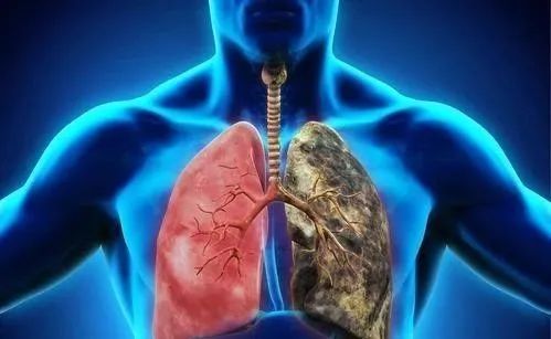 肺部结节 肺部结节