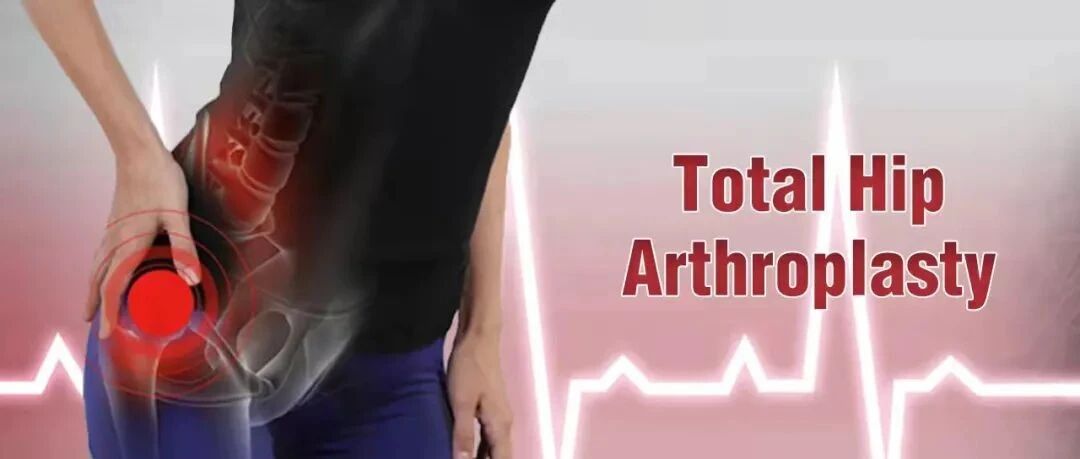 周密：肥厚型心肌病合并心衰老年髋部手术的围术期管理思路