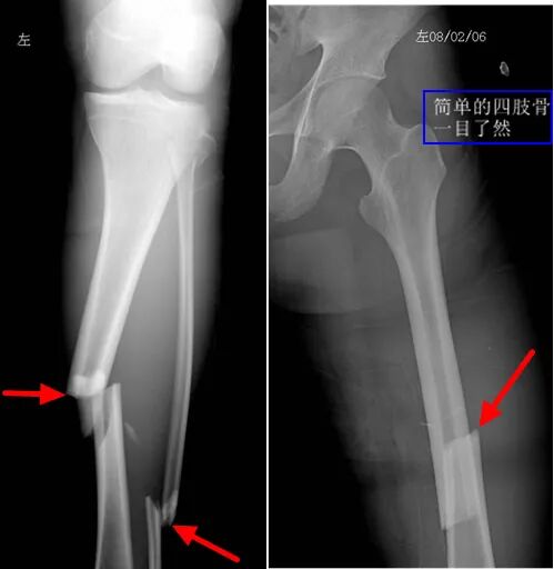 乳腺dr能检查什么【科普】DR、CT、MR？放射科检查项目选哪个好？_https://www.jmylbn.com_新闻资讯_第1张