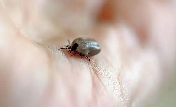 被螨虫咬的症状图片_螨虫疹图片和症状图片_螨虫病的症状图片图库