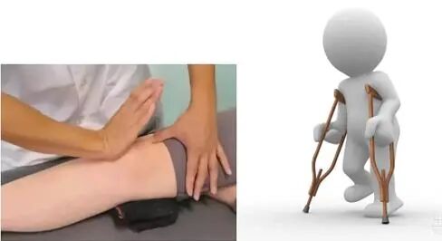 医学上ACL是什么【掌健识】前交叉韧带（ACL）断裂手术前后 ——该动则动_https://www.jmylbn.com_新闻资讯_第10张