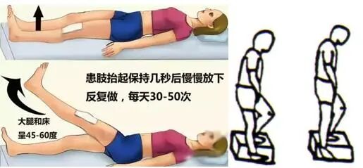 医学上ACL是什么【掌健识】前交叉韧带（ACL）断裂手术前后 ——该动则动_https://www.jmylbn.com_新闻资讯_第9张