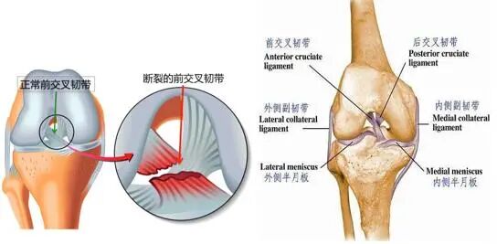 医学上ACL是什么【掌健识】前交叉韧带（ACL）断裂手术前后 ——该动则动_https://www.jmylbn.com_新闻资讯_第5张