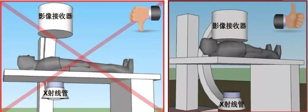 c型臂术中透视是什么手术室里的无形伤害，很多人却忽视了_https://www.jmylbn.com_新闻资讯_第7张