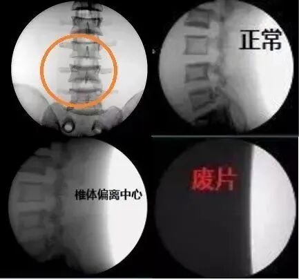 c型臂术中透视是什么手术室里的无形伤害，很多人却忽视了_https://www.jmylbn.com_新闻资讯_第8张