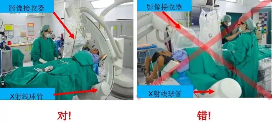 c型臂术中透视是什么手术室里的无形伤害，很多人却忽视了_https://www.jmylbn.com_新闻资讯_第5张