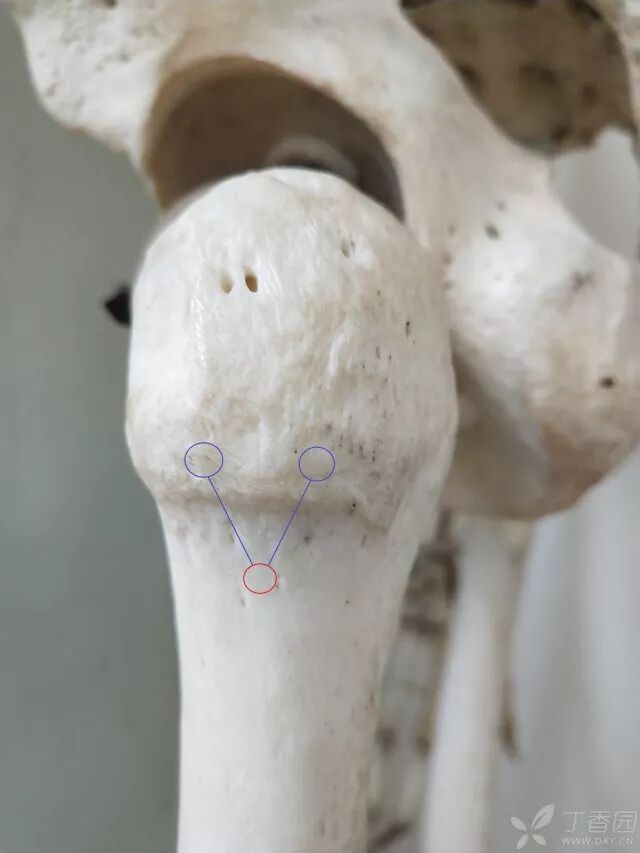 牵引床怎么用视频详解：如何不使用牵引床做好一台股骨颈骨折？_https://www.jmylbn.com_新闻资讯_第20张