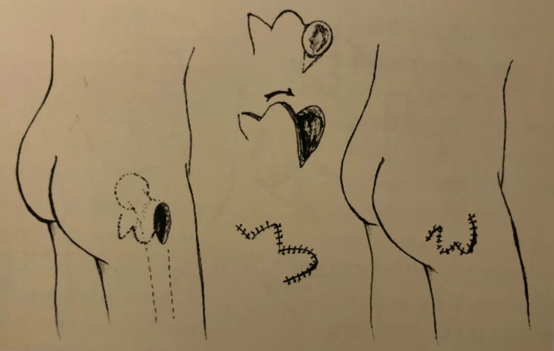 医疗缝线怎么做骨科精读 ｜ 如何做好手术缝合？这8种技术助你一臂之力！_https://www.jmylbn.com_新闻资讯_第14张