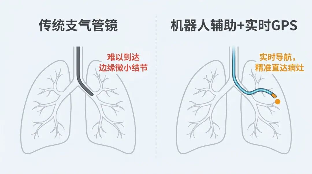 传统支气管镜与机器人辅助支气管镜的对比图解