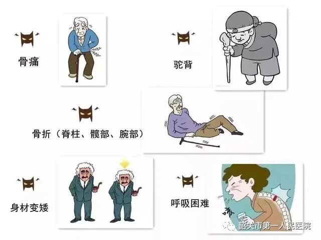 双能x骨密度检测仪为什么非得输入体重身高GE双能X线骨密度仪：检测骨质疏松的好助手_https://www.jmylbn.com_新闻资讯_第6张