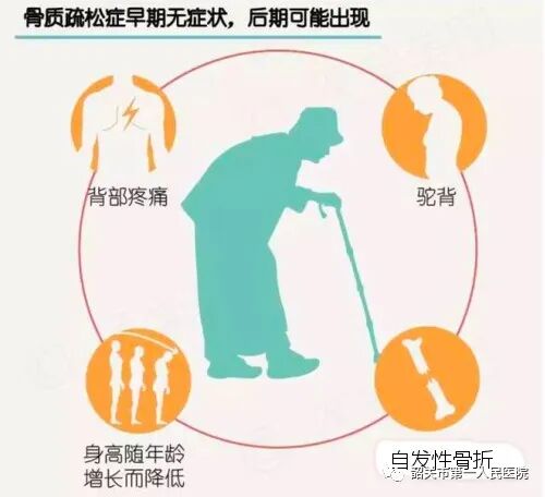 双能x骨密度检测仪为什么非得输入体重身高GE双能X线骨密度仪：检测骨质疏松的好助手_https://www.jmylbn.com_新闻资讯_第5张