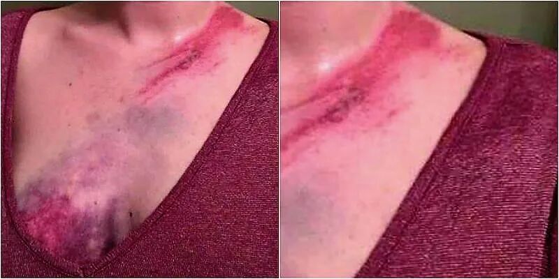 为什么胸部越大,发生交通事故时越容易受伤? - beebee公园 - 瓦斯阅读