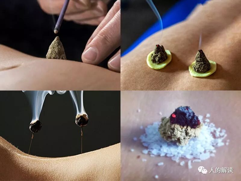 神奇的艾灸，为何无艾不成灸？-人的解读