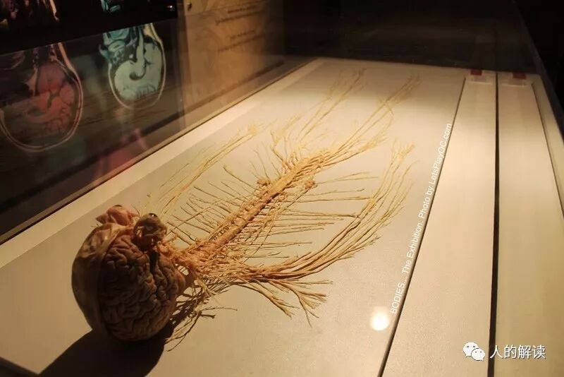 经络到底是什么，为何解剖学上找不到？-人的解读