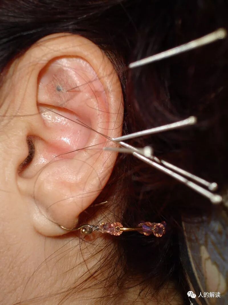 经络的全息特性，头痛医脚的道理原来是这样-人的解读