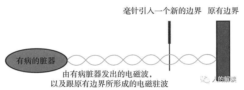 针灸治病的原理，想不到竟然是这样的-人的解读