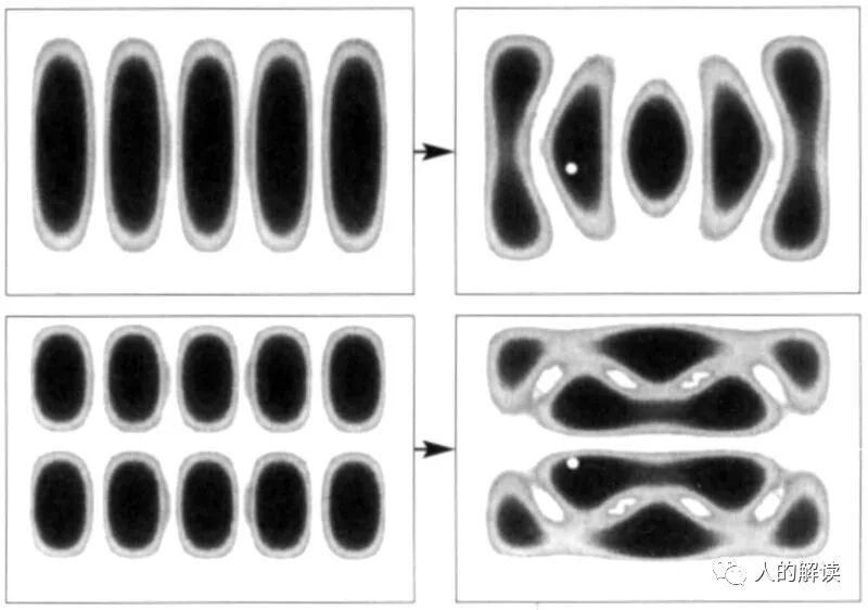 针灸治病的原理，想不到竟然是这样的-人的解读