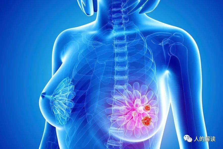 利用冥想治愈乳房肿块-人的解读