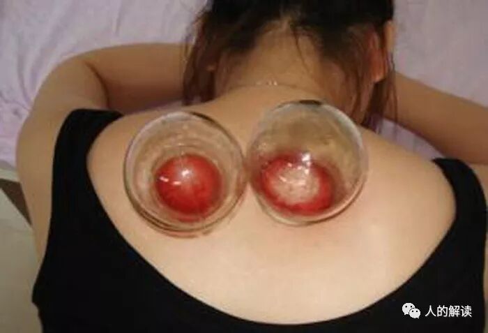 胡因梦的健康之路，神奇的另类疗法-人的解读