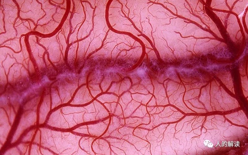 经络之所以解剖不着，原来因为它是耗散结构-人的解读