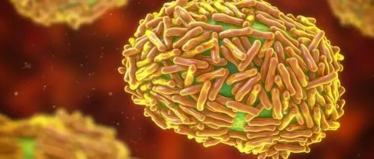 最新发现！这种病毒竟然能在水和冷藏食品中存活数周，加拿大中招人数最多！儿童更惨...