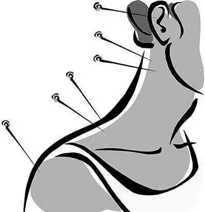 d-spect怎么检查【科普周刊245期】“歪脖子病”怎么办，核医学99mTc-MIBI SPECT／CT检查来助力_https://www.jmylbn.com_新闻资讯_第5张