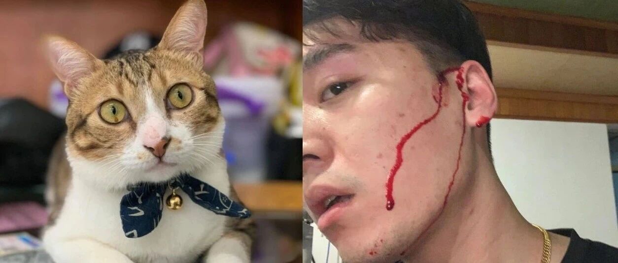 爱猫受惊抓破爸耳朵，他半面脸血流不止，最后他却做出惊人举动…